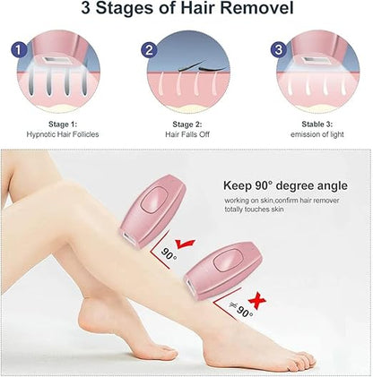 mini portable laser hair removal